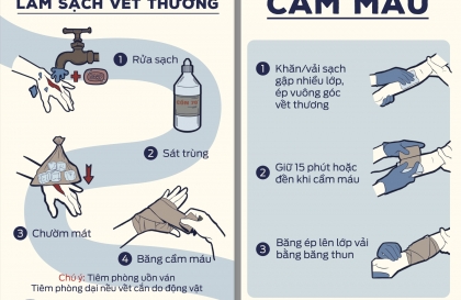 Kỹ năng sơ cứu cơ bản: Sơ cứu khi bị chó cắn